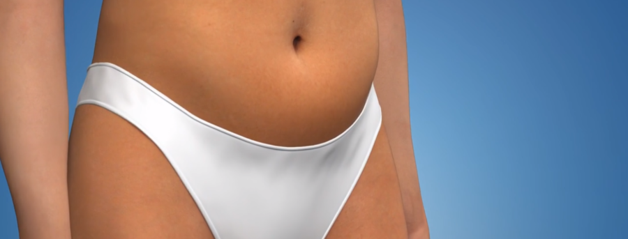 Αιδοιοπλαστική αιδοιοπλαστικη