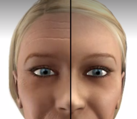 fractiona laser co2 fractiona laser co2