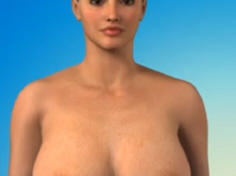 Μειωτική του μαστού μειωση μαστων