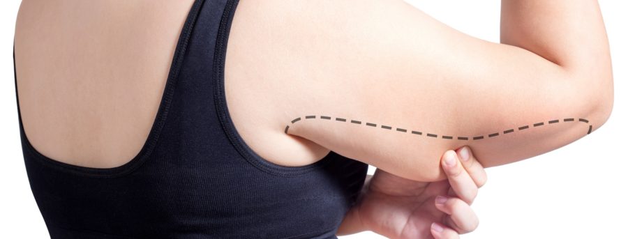 Βραχιονοπλαστική βραχιονοπλαστικη